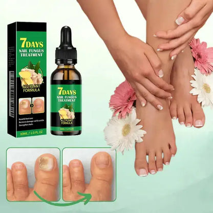 2ª UNIDAD TRATAMIENTO ANTI HONGOS 7 DÍAS 100% NATURAL