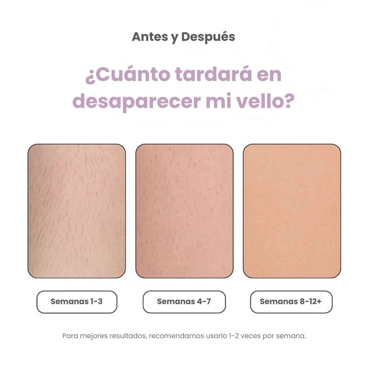 DEPILADORA LÁSER PERMANENTE