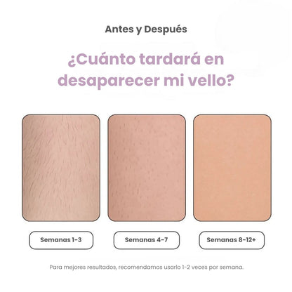 DEPILADORA LÁSER PERMANENTE