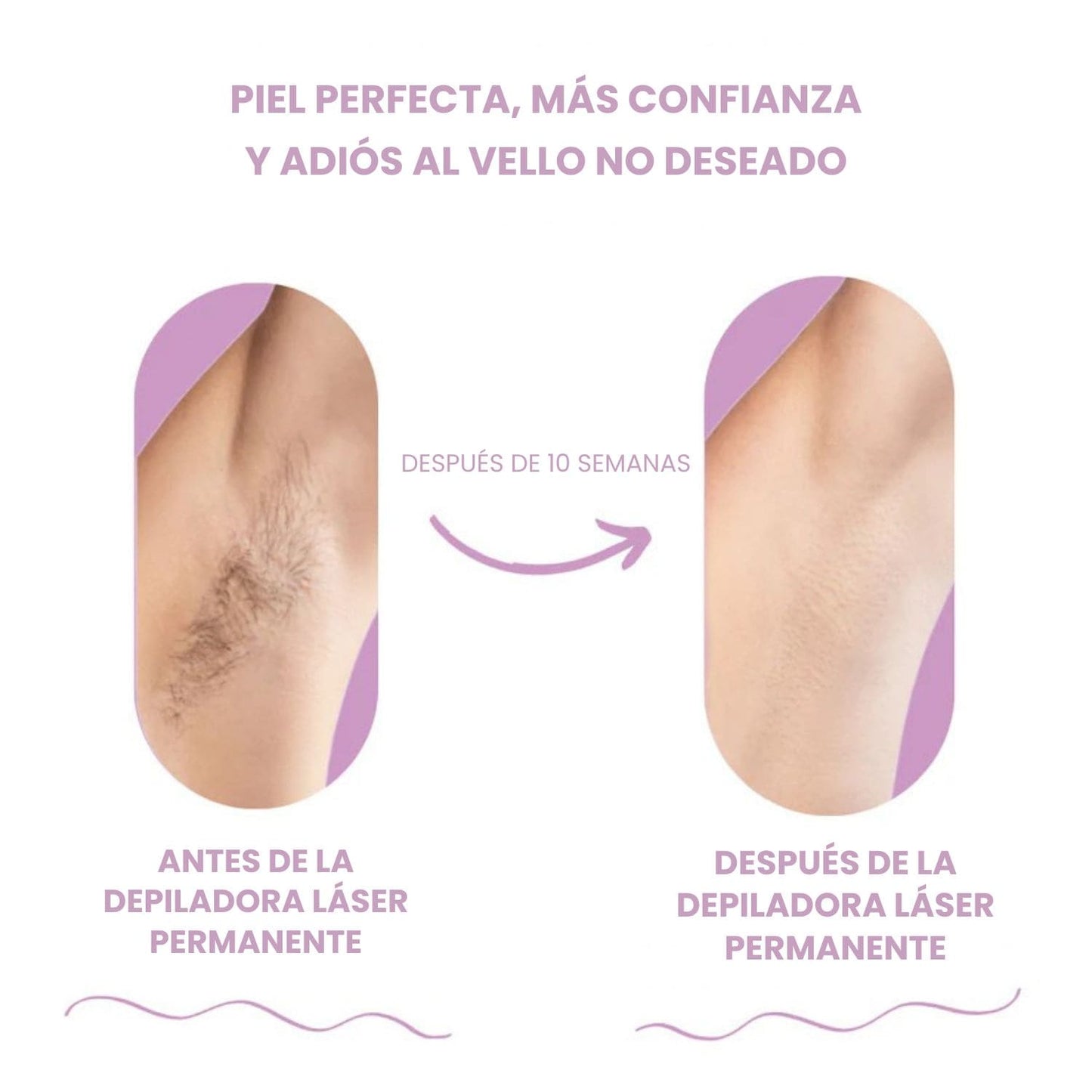 DEPILADORA LÁSER PERMANENTE