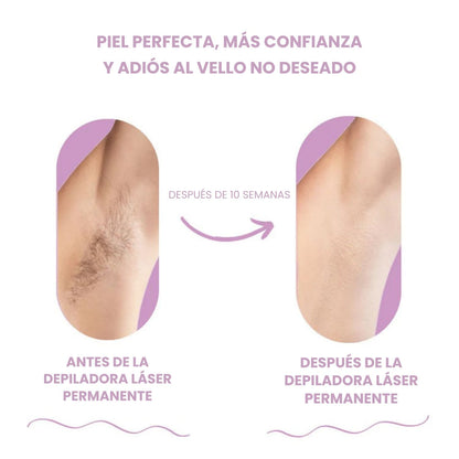 DEPILADORA LÁSER PERMANENTE