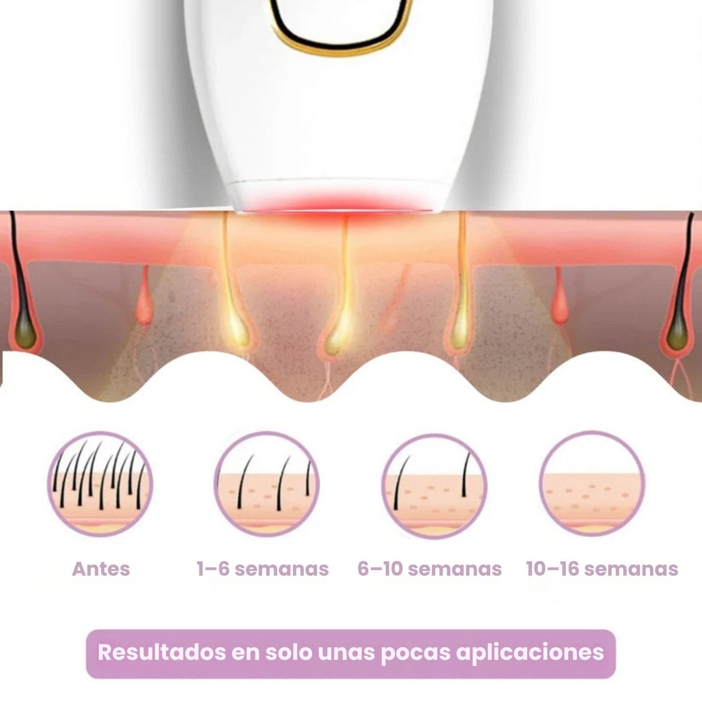 DEPILADORA LÁSER PERMANENTE