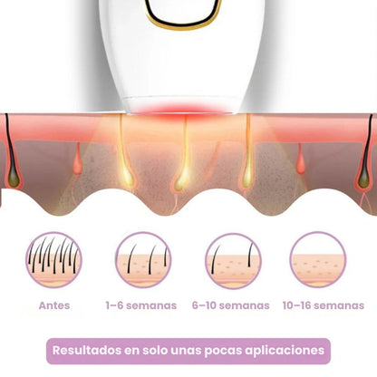 DEPILADORA LÁSER PERMANENTE