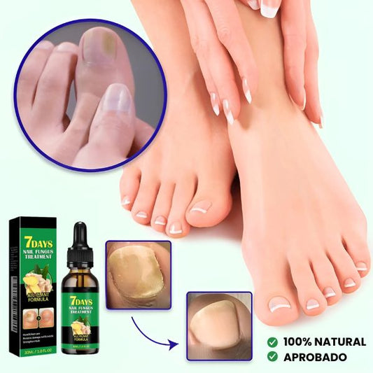 2ª UNIDAD TRATAMIENTO ANTI HONGOS 7 DÍAS 100% NATURAL